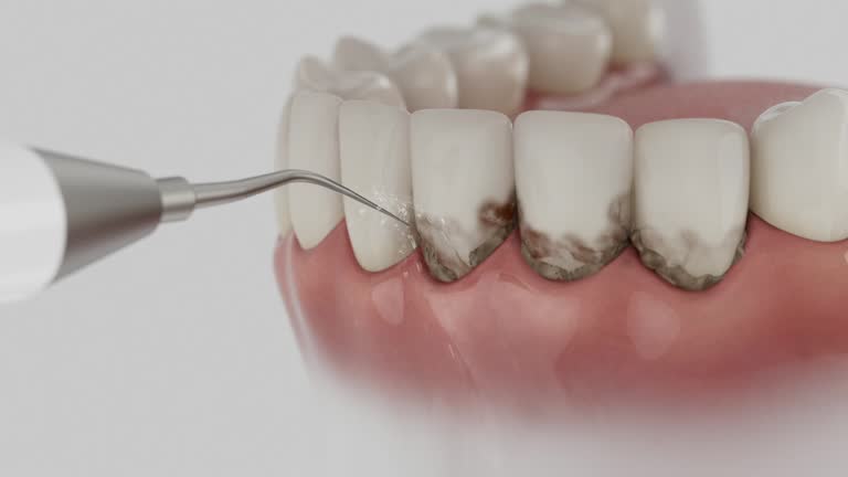 Reliable Wisdom Tooth Removal contractor in Oglala Lakota County County, SD by Dentist Open Now